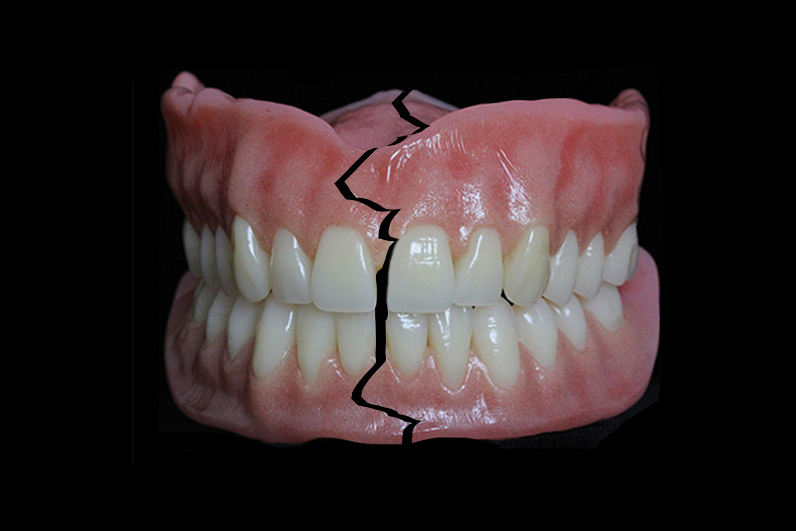 Denture Repair